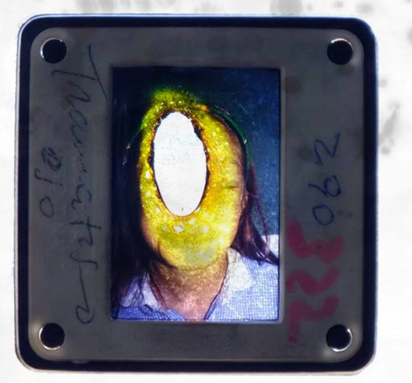 Piel expuesta, piel situada afuera.